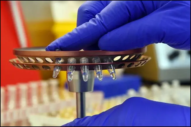 Сифилис в России растет у мужчин 40+: по другим ИППП идет спад