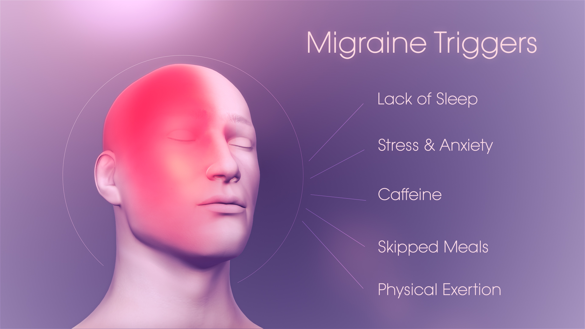 Medical-Animation-showing-Migraine-Triggers.jpg